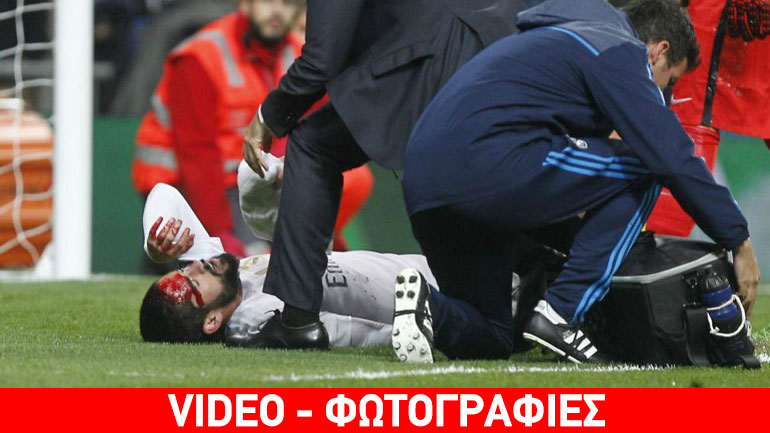 Ρεάλ Μαδρίτης: Με εννέα ράμματα στο κεφάλι έπαιξε ο Ίσκο