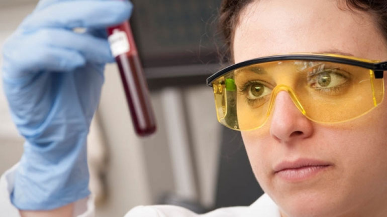 Νέο τεστ αίματος για τη διάγνωση του επιθετικού καρκίνου του προστάτη