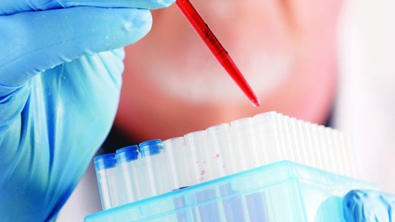 Ένα ετήσιο τεστ αίματος μπορεί να μειώσει τους θανάτους από καρκίνο των ωοθηκών