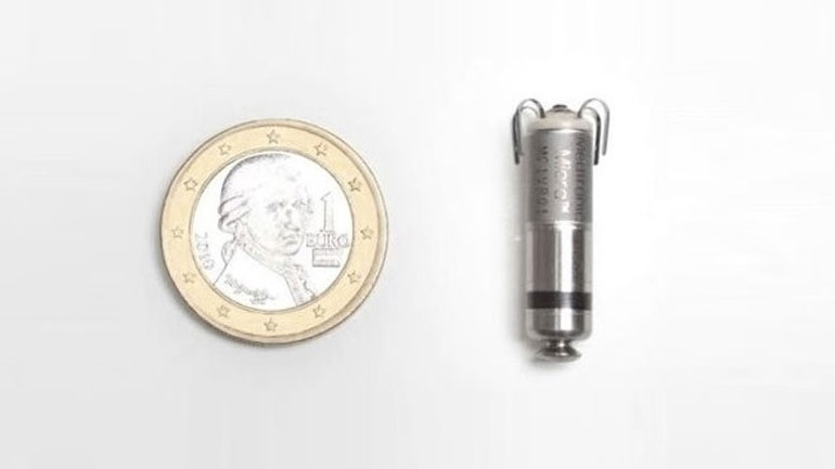 Η πρώτη εμφύτευση βηματοδότη χωρίς ηλεκτρόδια