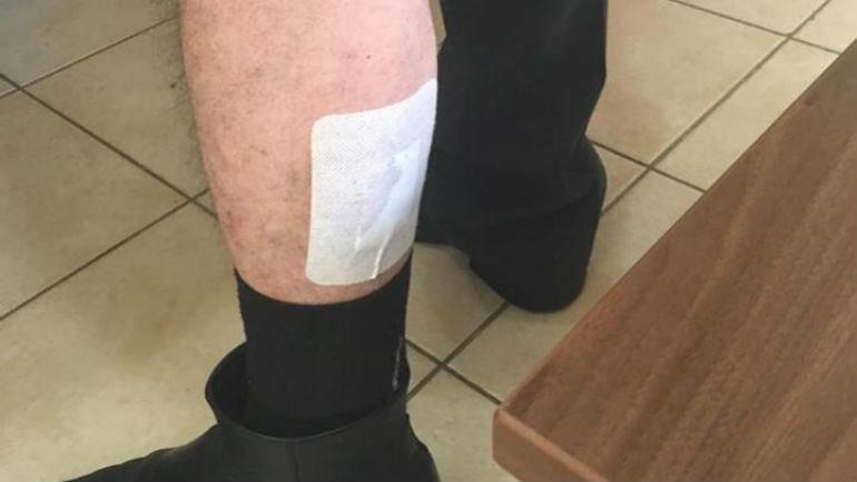 Φάρσαλα: 13 επιθέσεις σκύλων μέσα σε δύο μήνες