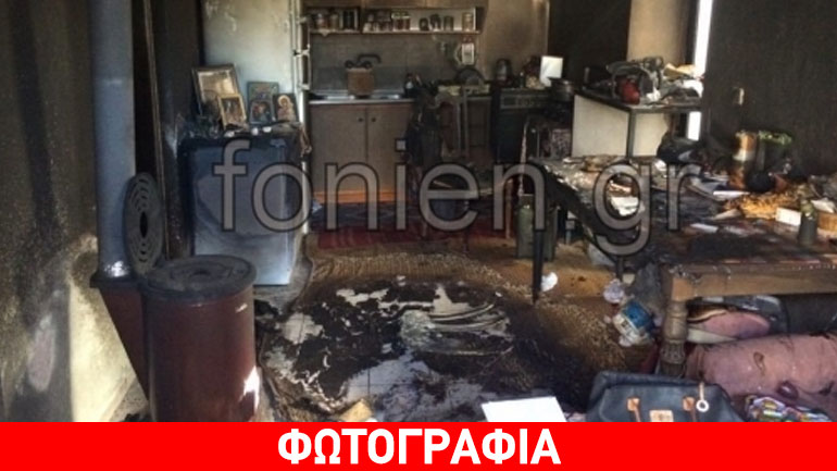 Δύσκολες ώρες για το αγοράκι που κάηκε από τη σόμπα