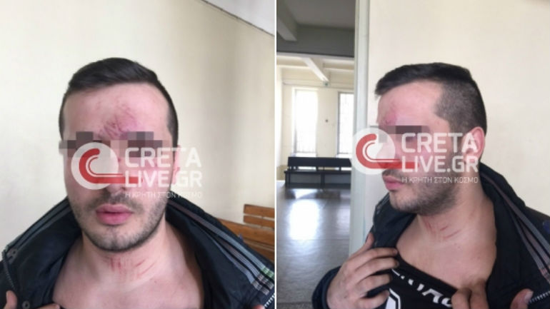 Ηράκλειο: Οκτώ αστυνομικοί ξυλοφόρτωσαν 23χρονο