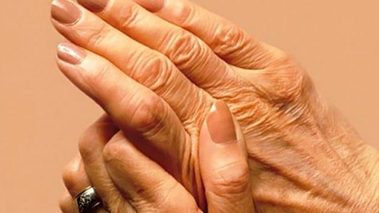 Αιματολογικό τεστ προβλέπει την αρθρίτιδα έως 16 χρόνια πριν από την εκδήλωσή της Αιματολογικό τεστ προβλέπει την αρθρίτιδα έως 16 χρόνια πριν από την εκδήλωσή της