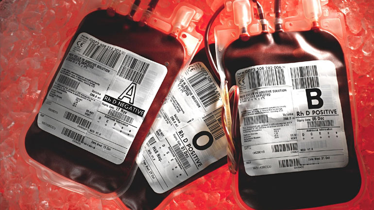 Έκκληση για αίμα στο νοσοκομείο του Ρίου – Σε σοβαρή κατάσταση νεαρή φοιτήτρια