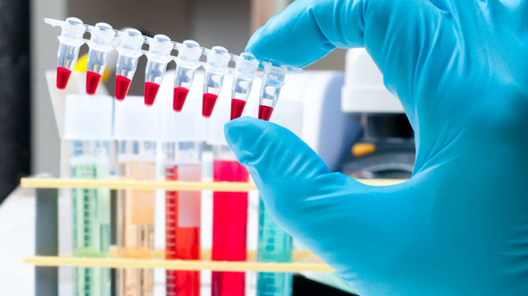 Στη Βρετανία θα ελέγχονται για ντόπινγκ οι Ρώσοι αθλητές