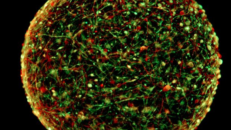 Έφτιαξαν μίνι ανθρώπινους εγκεφάλους σε εργαστήριο