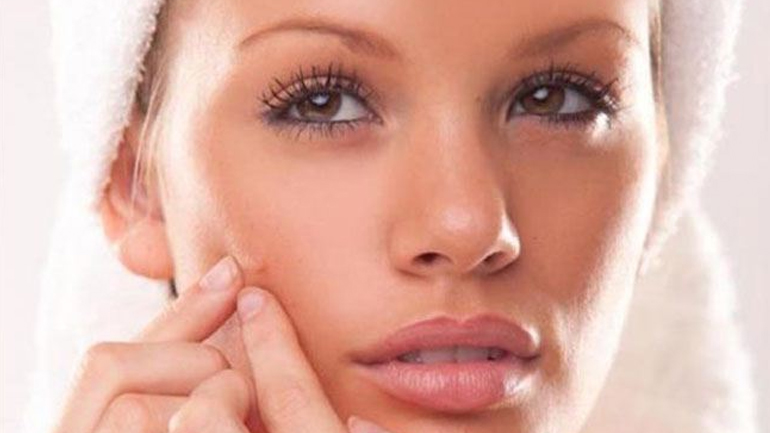 Εξαφανίστε τα μαύρα στίγματα με λεμόνι και άχνη