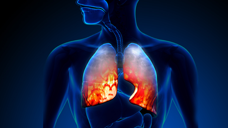 Δωρεάν σπιρομετρήσεις από τον Δήμο Θεσσαλονίκης