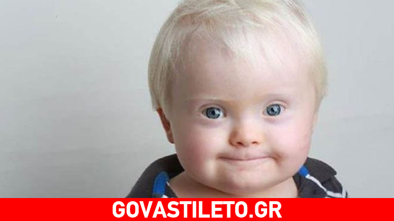 Πέντε μεγάλες αλήθειες για το σύνδρομο Down