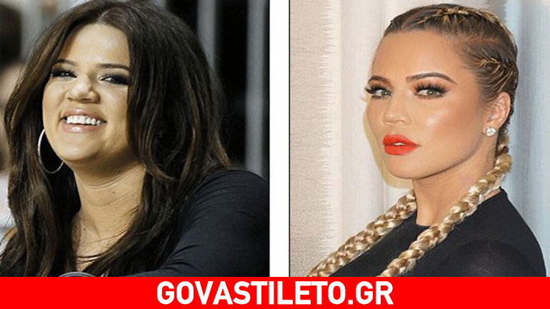 Khloe Kardashian: Αλλοιώθηκε πλήρως το πρόσωπό της από τις πλαστικές!