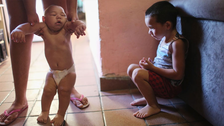 Στο 1% η πιθανότητα γέννησης μωρού με μικροκεφαλία λόγω του ιού Ζίκα