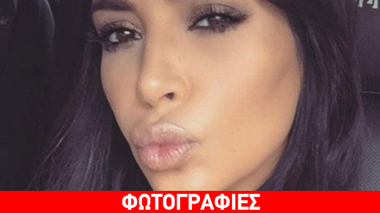 Η Kim Kardashian έχει τα δικά της «hot lips»