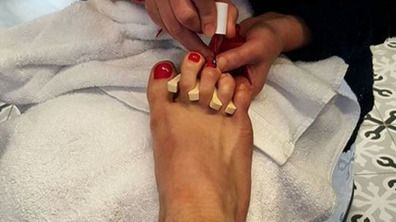 Δεν θα πιστεύετε ποιος Έλληνας έβαψε κόκκινα τα νύχια των ποδιών του!