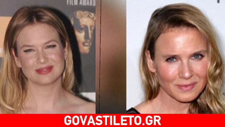 Renee Zellweger: Πώς είναι σήμερα μετά τη σοκαριστική αλλαγή στο πρόσωπό της;