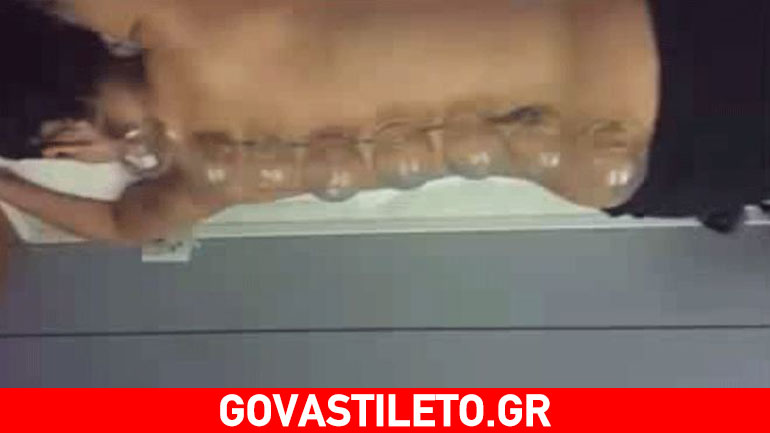 Μαρία Κορινθίου: Της έκοψαν… βεντούζες και μας το έδειξε!