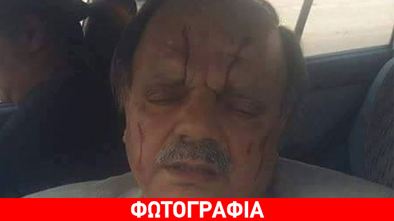 Ξυλοκόπησαν υποψήφιο βουλευτή του ΔΗΚΟ