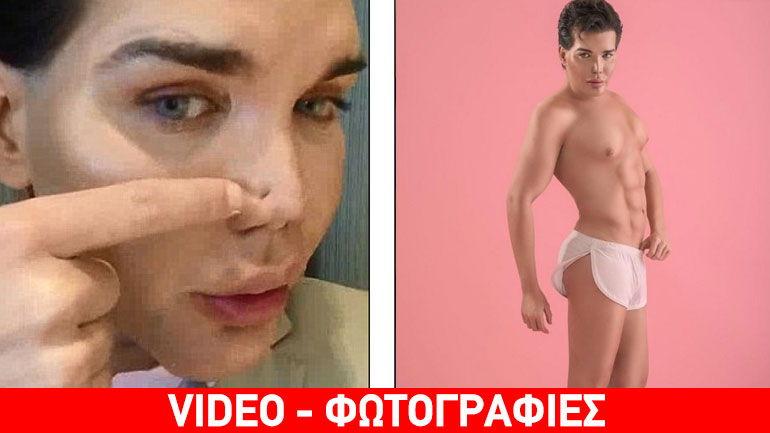 Εσπευσμένα στο νοσοκομείο ο άνδρας που μοιάζει με τον «Κεν» της Μπάρμπι -Έχει ξοδέψει 386.000 ευρώ σε 42 επεμβάσεις