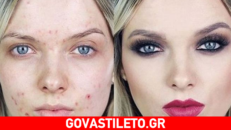 Η μεταμόρφωση μιας 26χρονης blogger που δέχεται bullying για το πρόσωπό της