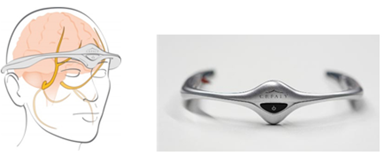 Εικόνα 4: Νευροτροποποίηση με τη χορήγηση μικρορρεύματος, από το προϊόν CEFALY