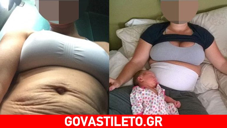 Ποια διάσημη κυρία έδειξε το κορμί της μετά τη γέννα χωρίς ίχνος ρετούς;