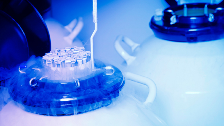 Η κατάψυξη σπερματοζωαρίων μπορεί να προλάβει τις γενετικές διαταραχές