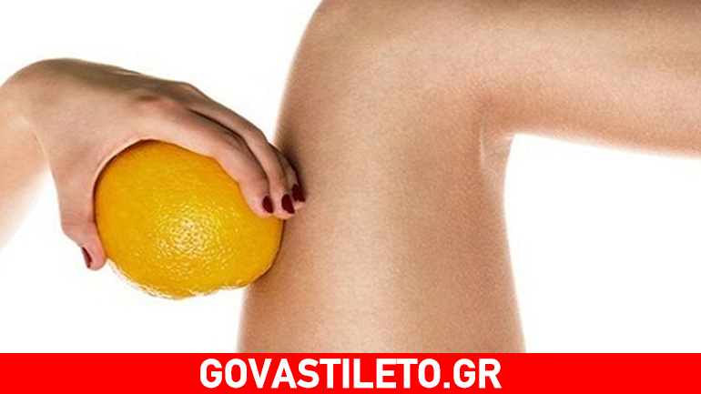 Αυτά είναι τα τέσσερα στάδια της κυτταρίτιδας