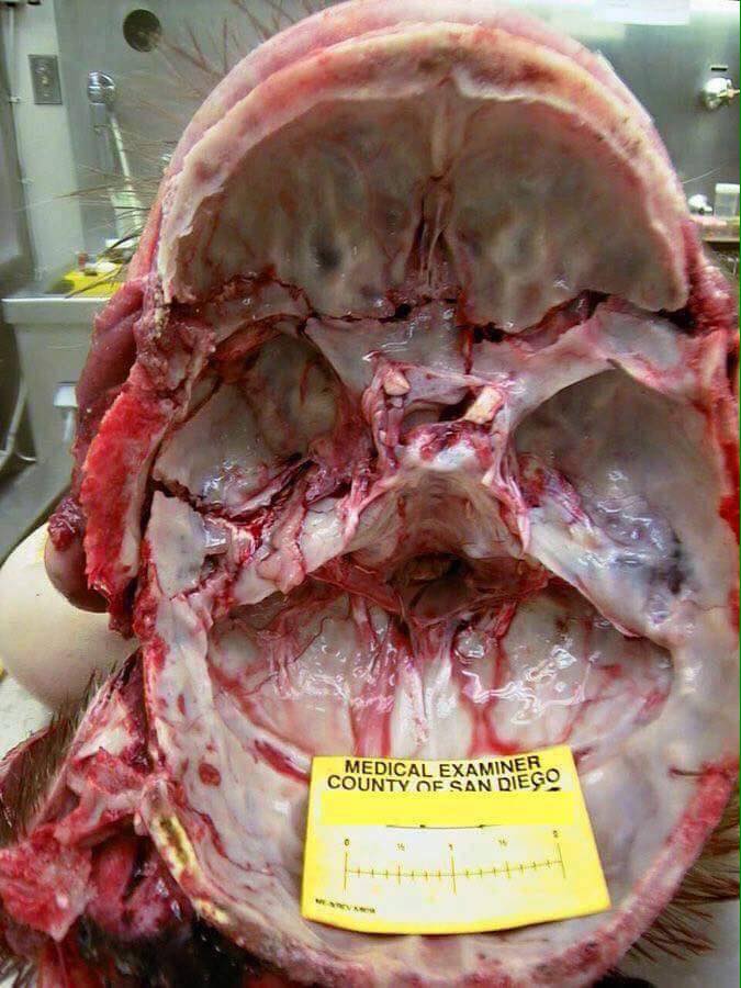 Μία ανάρτηση συνοδευόμενη από ένα σπασμένο κρανίο σίγουρα προκαλεί σοκ...