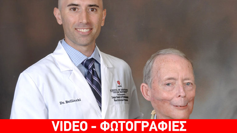 Καρκινοπαθής απέκτησε σαγόνι από 3D εκτυπωτή