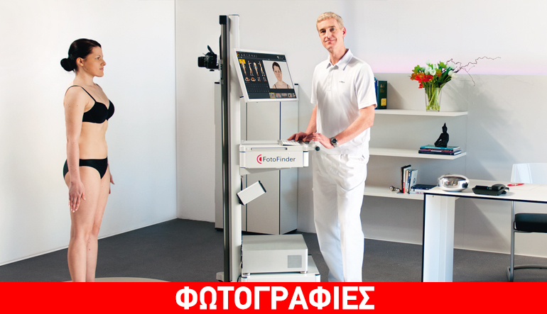 Δερματικοί σπίλοι (Ελιές): Νέα ψηφιακή μέθοδος για την ολόσωμη χαρτογράφηση & την πρόληψη του δερματικού καρκίνου