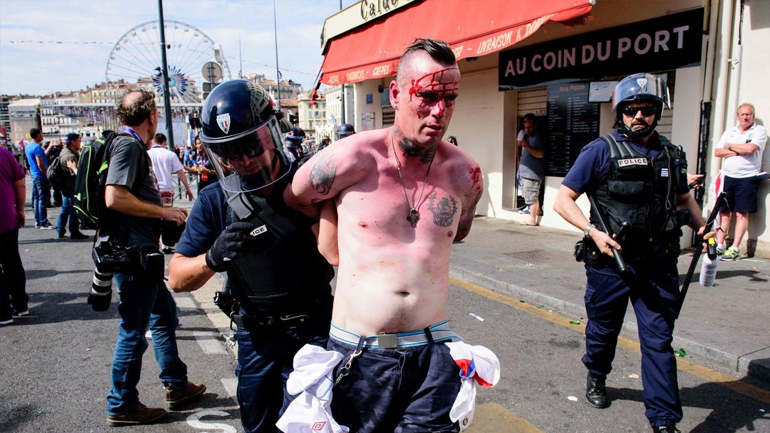 Νεκρός οπαδός στο Euro