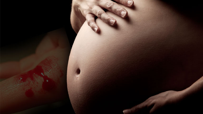 Αιμορραγία στην εγκυμοσύνη δεν σημαίνει πάντα αποβολή