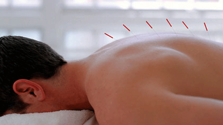 Βελονισμός και στυτική δυσλειτουργία