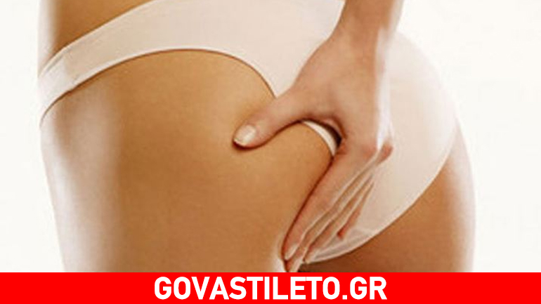 Αποτελεσματική κρέμα σώματος για την κυτταρίτιδα