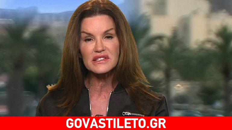 Η Janice Dickinson βγήκε νικήτρια από τον καρκίνο στο στήθος – Όσα αποκάλυψε σε εκπομπή