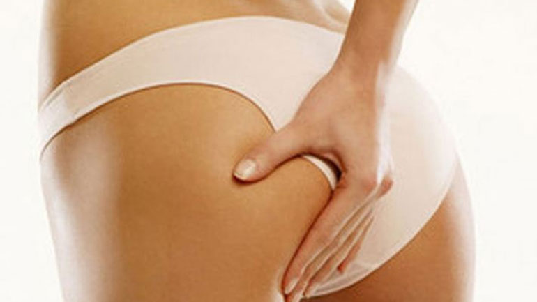 Σπιτική κρέμα σώματος για την κυτταρίτιδα