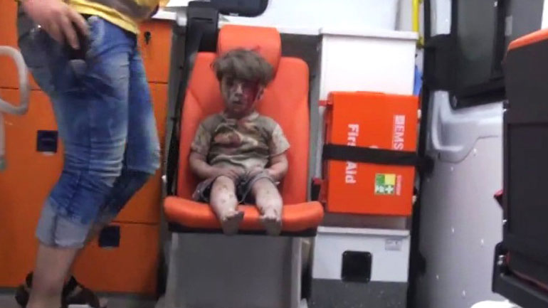 Ο Ομράν, παιδί θύμα όπως τόσα άλλα στον συριακό πόλεμο