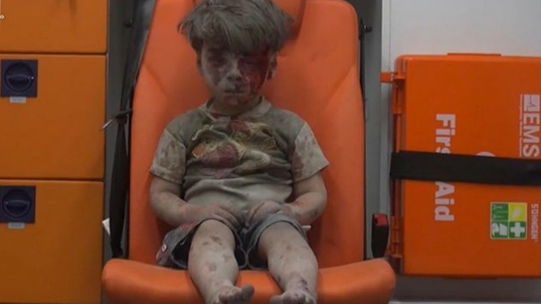 Συρία: Υπέκυψε στα τραύματά του ο αδερφός του μικρού Ομράν