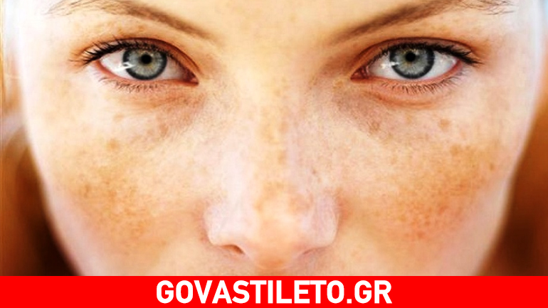 Δώσε τέλος στις πανάδες της εγκυμοσύνης