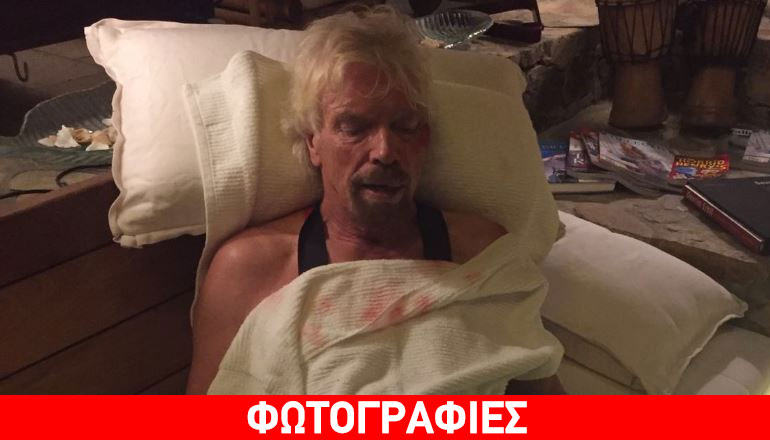 «Είδα τη ζωή να περνάει μπροστά από τα μάτια μου» λέει ο κροίσος Μπράνσον μετά από ατύχημα με ποδήλατο