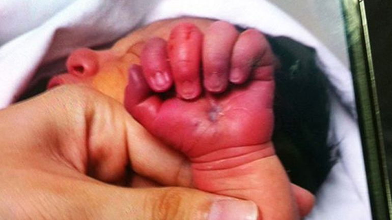 Κατερίνη: Γέννησε και έριξε το νεογέννητο στον φωταγωγό