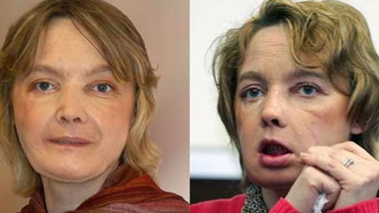 Γαλλία: Απεβίωσε η πρώτη γυναίκα που υποβλήθηκε σε μεταμόσχευση προσώπου