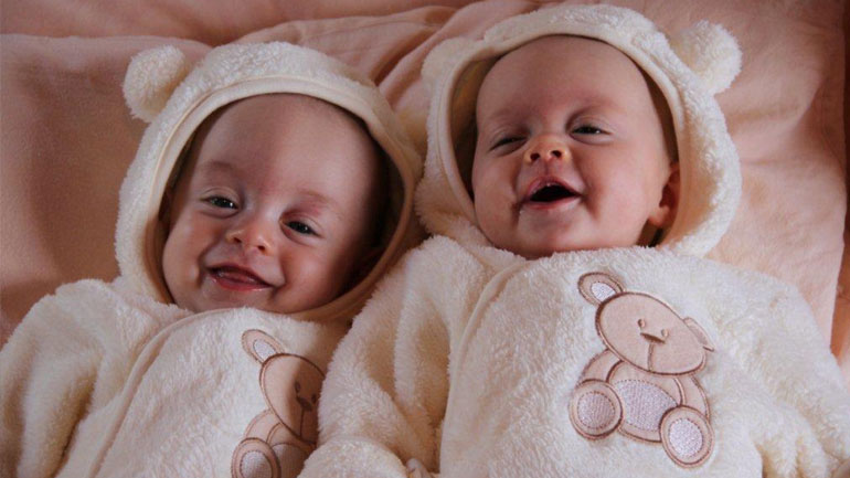 Ελαχιστοποιείται ο κίνδυνος θανάτου όταν τα δίδυμα γεννιούνται την 37η εβδομάδα