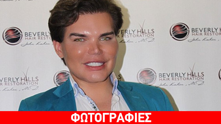 Ο άνθρωπος-κούκλα συνεχίζει τη μεταμόρφωσή του