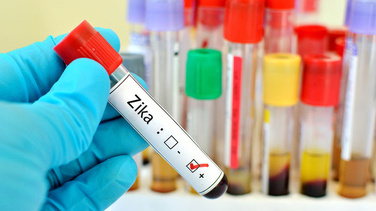 Μαλαισία: Επιβεβαιώθηκε το πρώτο κρούσμα του ιού Ζίκα σε έγκυο