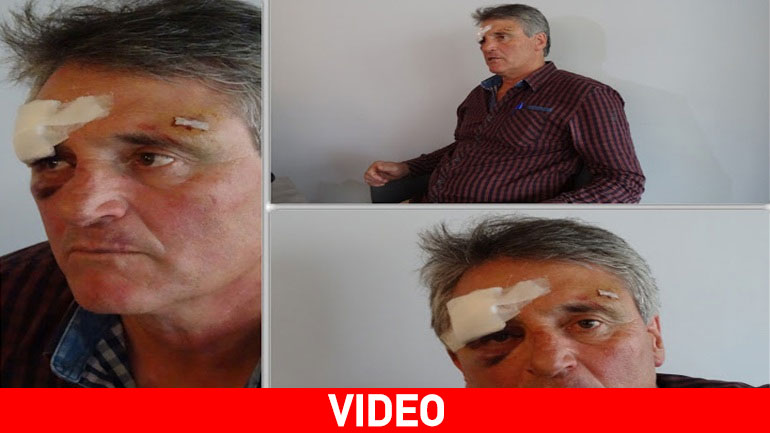 Άγριο ξυλοδαρμό από αστυνομικούς καταγγέλλει γνωστός επιχειρηματίας των Ιωαννίνων