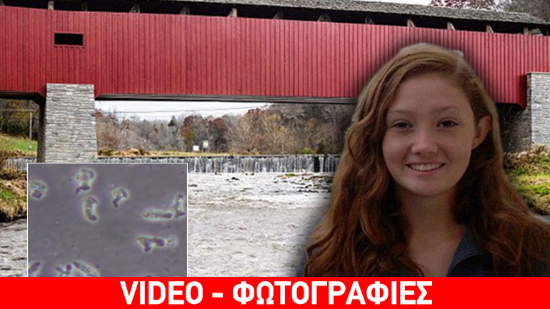 ΗΠΑ: 19χρονη κολυμβήτρια πέθανε από σπάνια αμοιβάδα που “τρώει τον εγκέφαλο”