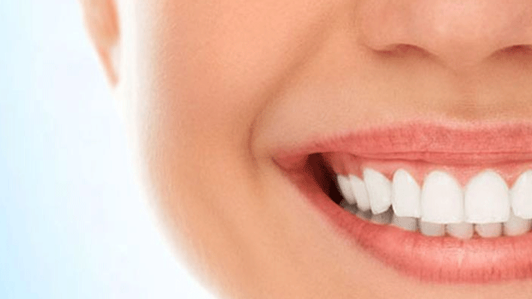 Αόρατοι νάρθηκες! Ξεχάστε πλέον τα κλασικά σιδεράκια στα δόντια