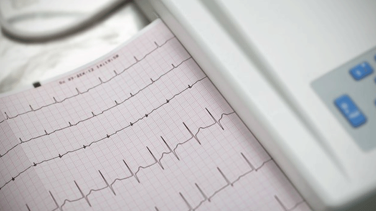 Οι γυναίκες με κολπικό ινιδισμό ζουν περισσότερο από τους άνδρες αλλά με σοβαρή έκπτωση στην ποιότητα ζωής