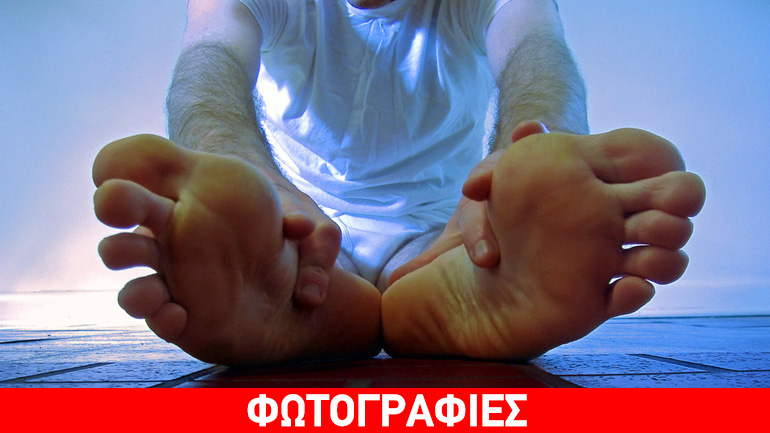 Μάθετε τα πάντα για την πελματιαία απονευρωσίτιδα